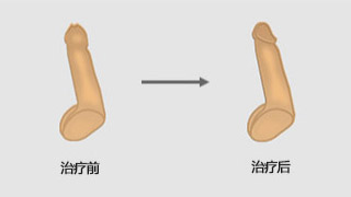 昌吉男科医院哪家好