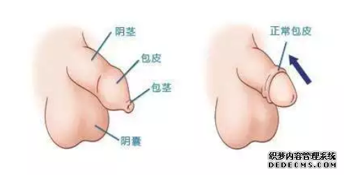 阿拉尔市包皮过长会给女性带来哪些危害？